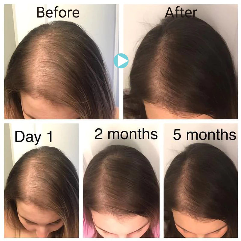 The Ordinary
The Ordinary Multi-Peptide Serum for Hair Density