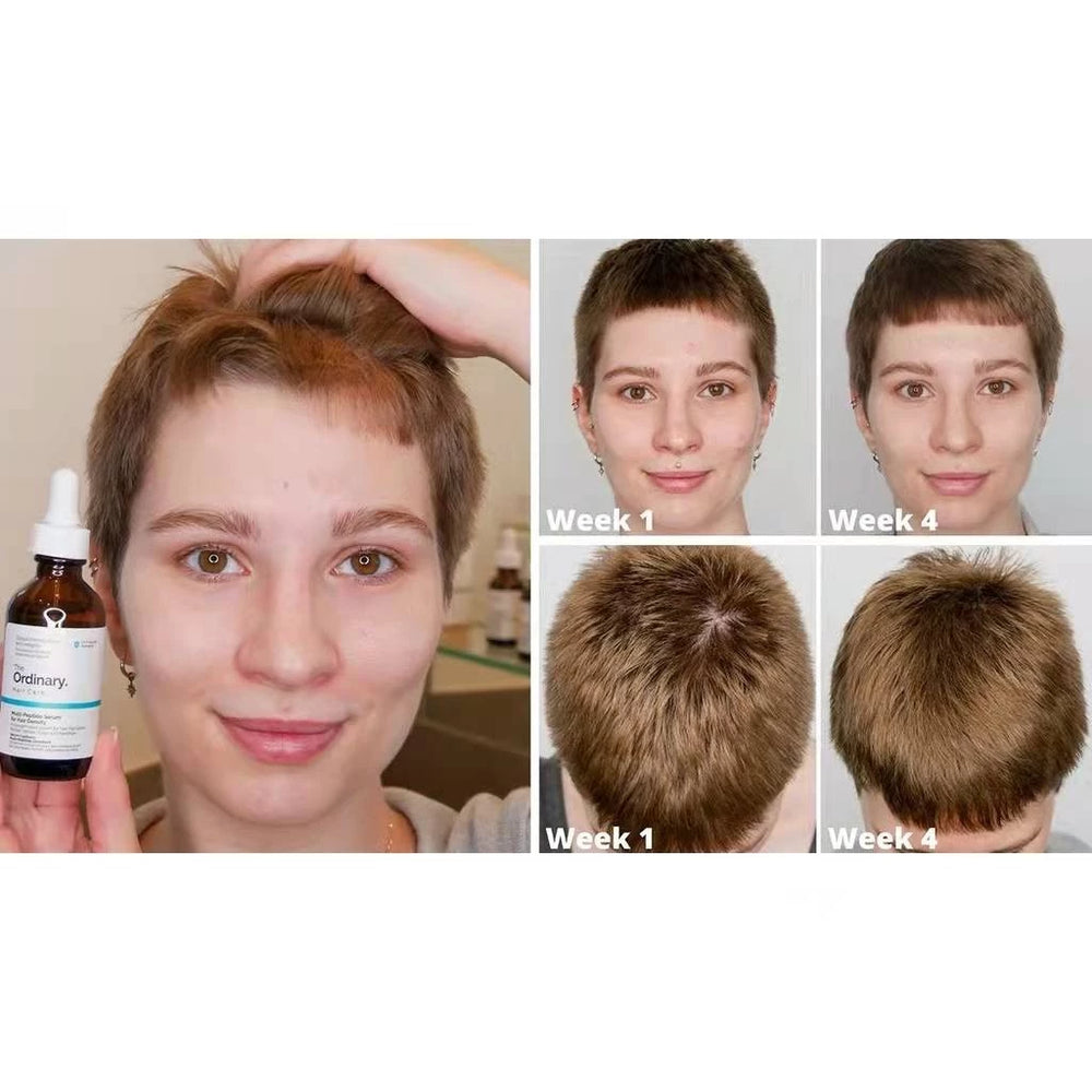 The Ordinary
The Ordinary Multi-Peptide Serum for Hair Density