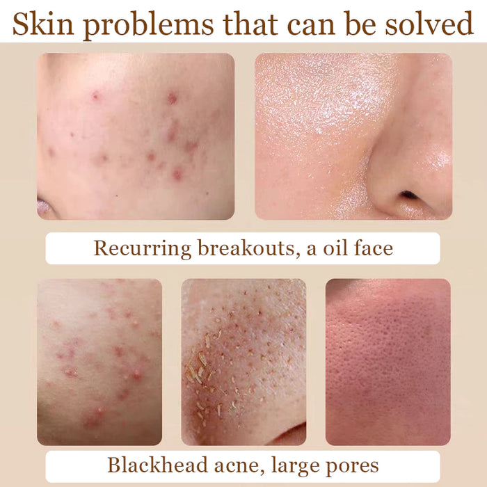 The Ordinary
Glycolic Acid 7% Exfoliating Toner 240ml (previously Toning Solution)