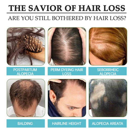 The Ordinary
The Ordinary Multi-Peptide Serum for Hair Density