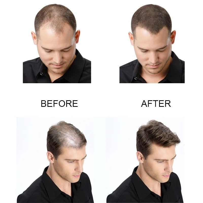 The Ordinary
The Ordinary Multi-Peptide Serum for Hair Density