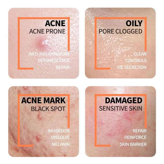 The Ordinary Niacinamide 10% + Zinc 1