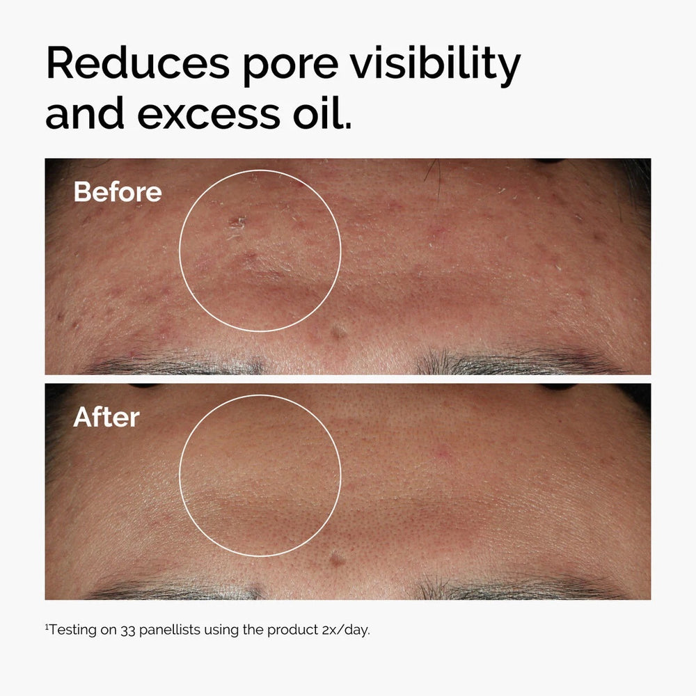 The Ordinary Niacinamide 10% + Zinc 1