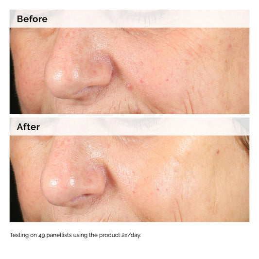 The Ordinary
Alpha Arbutin 2% + HA